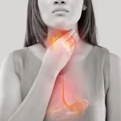 Une femme se tient la gorge, une zone rougeoyante symbolisant un estomac trop acide. L'image montre l'œsophage et l'estomac.