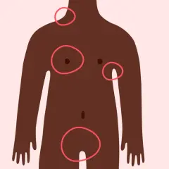 Silhouette féminine avec des cercles rouges indiquant des zones d'intérêt, dont ou se situe l'aine femme.