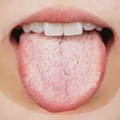 Une langue blanche et râpeuse, signe possible de stress ou d'une infection.