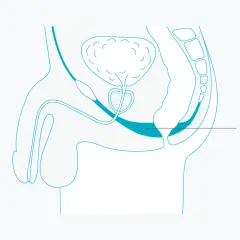Schéma anatomique montrant le muscle pelvien homme, essentiel pour le soutien des organes et la fonction urinaire.