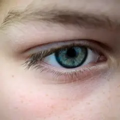 Gros plan sur un œil bleu-vert, avec des taches de rousseur sur la joue. La paupière qui tremble depuis plusieurs semaines est visible.