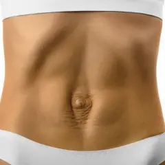 Ventre avec peau relâchée et vergetures, montrant un possible diastasis. Comment savoir si c'est le cas ?