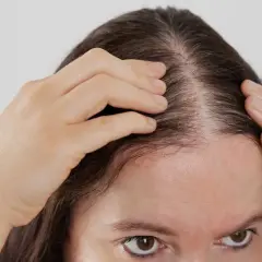 Une femme examine la densité de ses cheveux, s'interrogeant sur les bienfaits de la vitamine D pour cheveux.