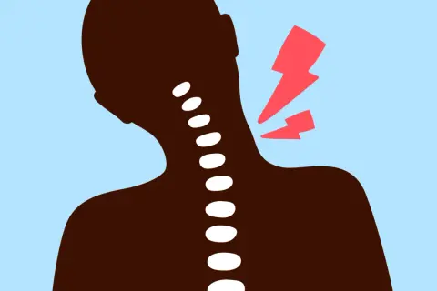 Silhouette d'une personne souffrant d'un torticolis chaud ou froid, avec des éclairs rouges symbolisant la douleur au niveau du cou.