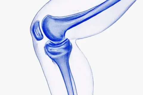 Illustration bleue d'un genou, montrant les os et le cartilage. Une vision pour régénérer le cartilage naturellement.