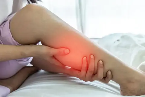 Une personne se tient la jambe, le mollet dur et gonflé, avec une zone rouge indiquant la douleur.