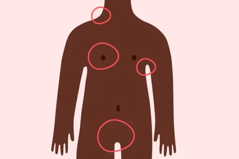 Silhouette féminine avec des cercles rouges indiquant des zones d'intérêt, dont ou se situe l'aine femme.