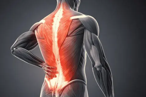 Anatomie d'un homme montrant la douleur du dos droite, avec les muscles du bas du dos illuminés en rouge vif.