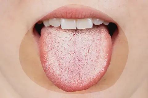 Une langue blanche et râpeuse, signe possible de stress ou d'une infection.