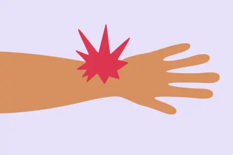 Main gauche blessée, une étoile rouge symbolise la douleur au doigt majeur.