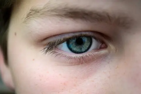 Gros plan sur un œil bleu-vert, avec des taches de rousseur sur la joue. La paupière qui tremble depuis plusieurs semaines est visible.