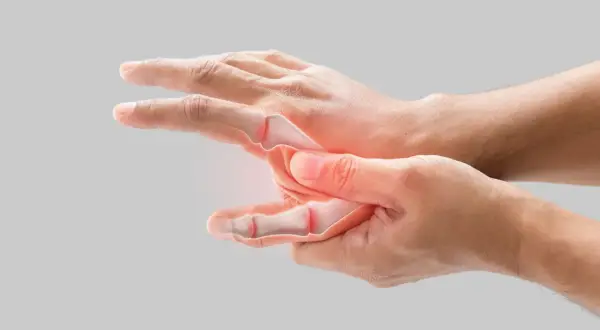 Main gauche avec articulations enflammées, suggérant un mal au poignet quand je le plie.
