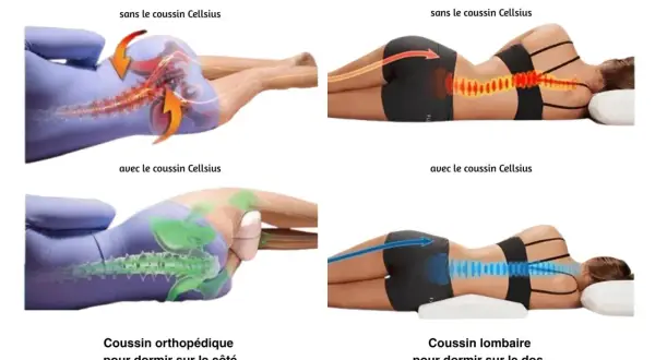 Comparaison de la posture de sommeil : sans coussin, la colonne vertébrale est tordue, causant douleur au muscle du dos. Avec coussin, alignement amélioré.