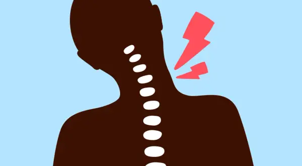 Silhouette d'une personne souffrant d'un torticolis chaud ou froid, avec des éclairs rouges symbolisant la douleur au niveau du cou.