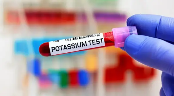 Main tenue un tube de test sanguin étiqueté "POTASSIUM TEST". Un manque de potassium peut être détecté.
