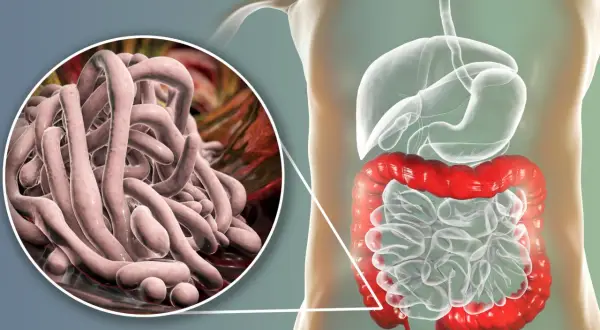 Gros plan sur des parasites intestinaux, avec une illustration du système digestif humain. Une vision pour un vermifuge humain naturel.
