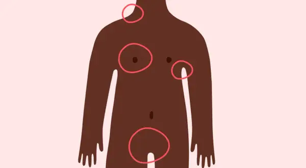 Silhouette féminine avec des cercles rouges indiquant des zones d'intérêt, dont ou se situe l'aine femme.