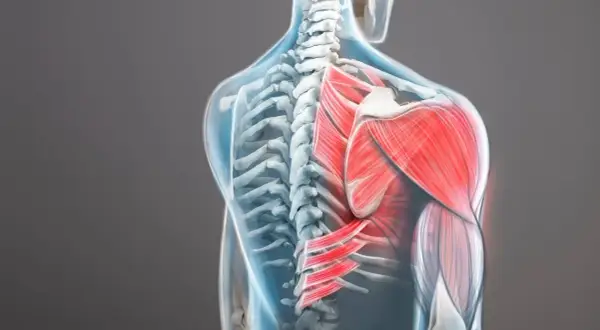 Vue anatomique du dos montrant une contracture trapèze qui ne passe pas, avec les muscles en rouge vif.