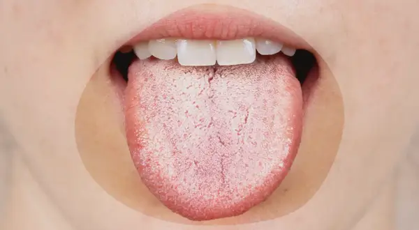 Une langue blanche et râpeuse, signe possible de stress ou d'une infection.