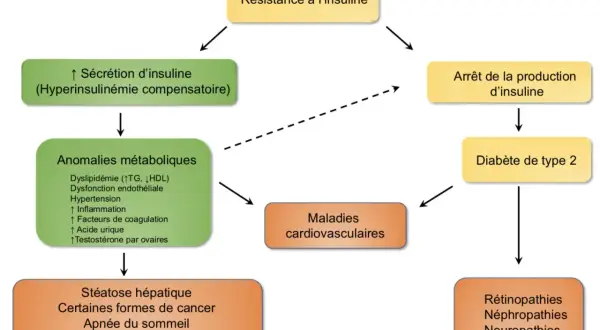 Schéma montrant comment la résistance à l'insuline mène à des anomalies métaboliques, puis à des maladies cardiovasculaires, ou à l'arrêt de la production d'insuline et au diabète de type 2.