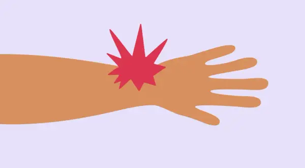 Main gauche blessée, une étoile rouge symbolise la douleur au doigt majeur.