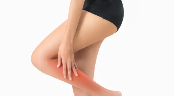 Une femme se tient la jambe droite, une zone rouge vif indiquant une douleur au mollet droit.