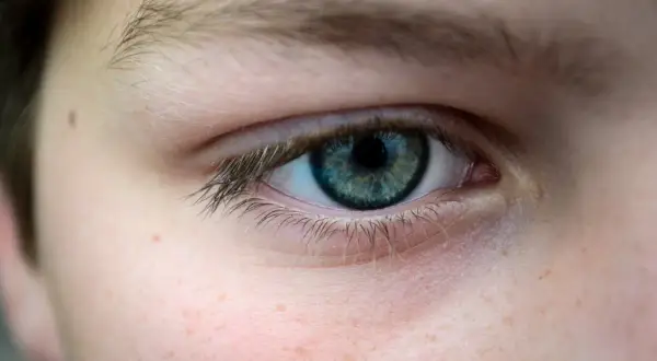 Gros plan sur un œil bleu-vert, avec des taches de rousseur sur la joue. La paupière qui tremble depuis plusieurs semaines est visible.