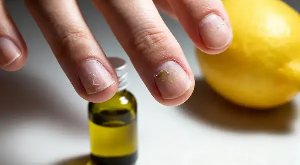 Main abîmés, un flacon d'huile et un citron, symboles d'un aliment bon pour les cheveux et ongles.