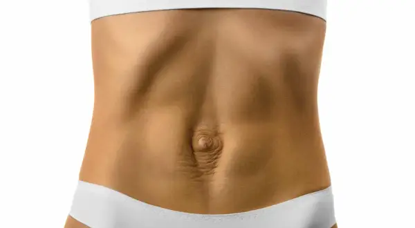 Ventre avec peau relâchée et vergetures, montrant un possible diastasis. Comment savoir si c'est le cas ?