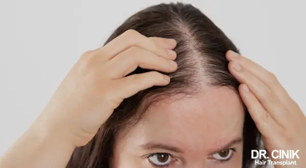 Une femme examine la densité de ses cheveux, s'interrogeant sur les bienfaits de la vitamine D pour cheveux.
