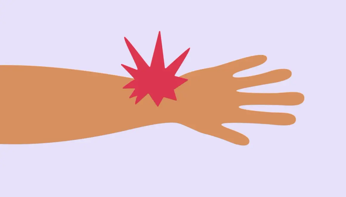 Main gauche blessée, une étoile rouge symbolise la douleur au doigt majeur.