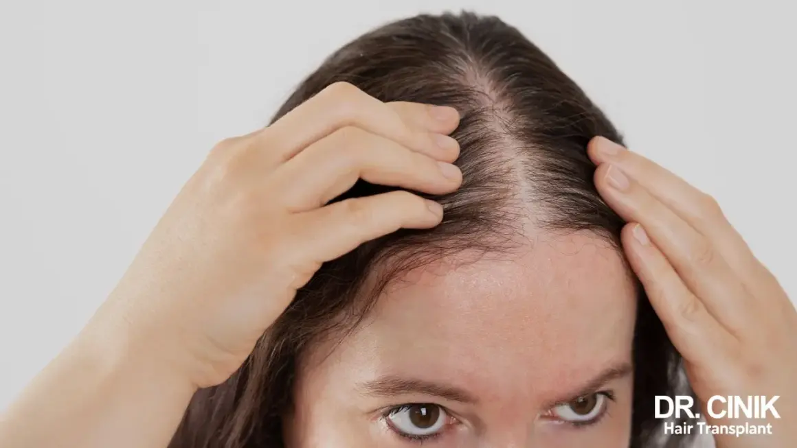 Une femme examine la densité de ses cheveux, s'interrogeant sur les bienfaits de la vitamine D pour cheveux.