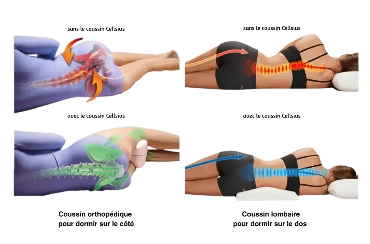 Comparaison de la posture du dos sans et avec coussin. Évite le faux mouvement dos en position latérale ou dorsale.