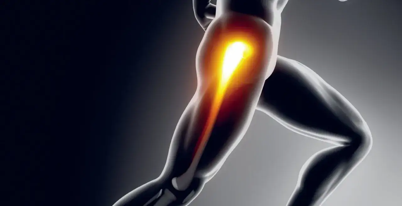 Une jambe en mouvement, avec une zone de chaleur intense au niveau de la hanche, symbolisant la douleur lors de la course à pied.