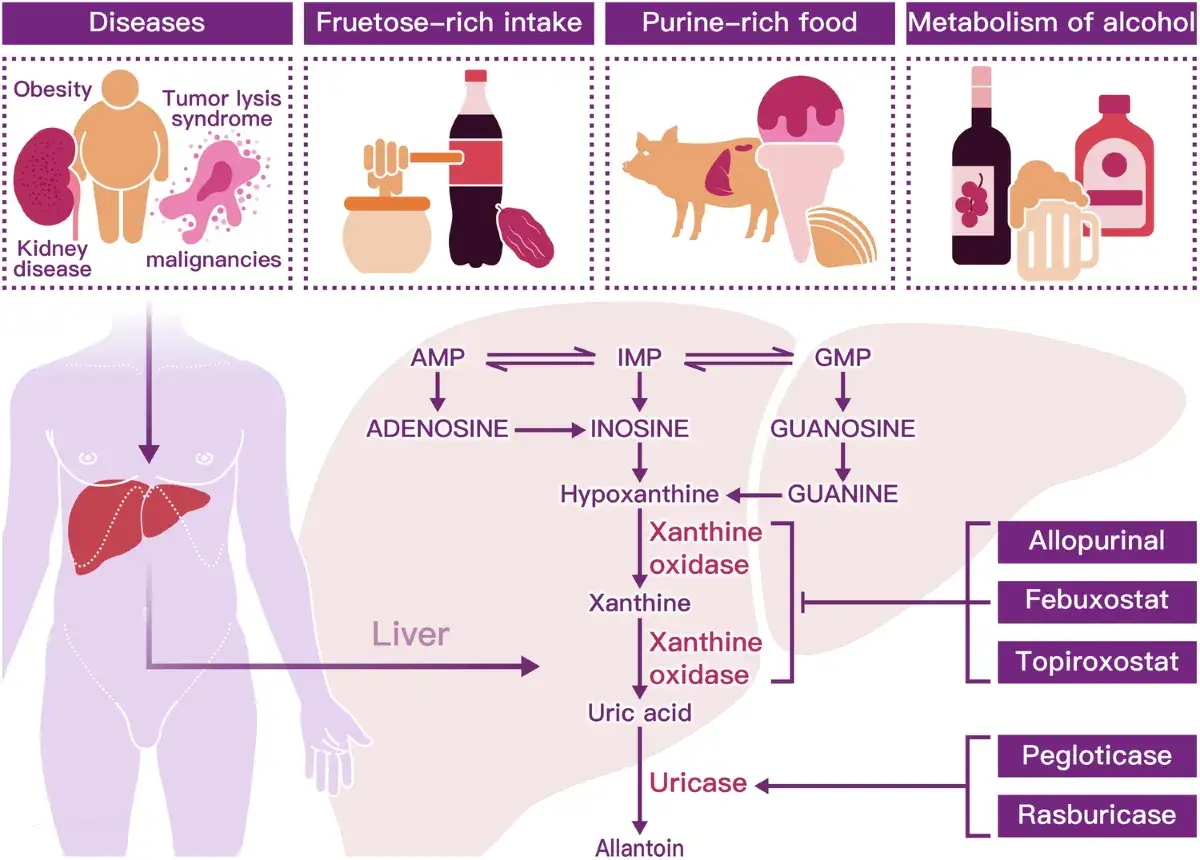 Schéma expliquant ce qu'est l'acide urique : son métabolisme hépatique, les facteurs favorisant son excès (obésité, alimentation riche en fructose/purines, alcool) et les médicaments pour le traiter.