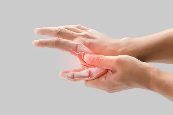 Main gauche avec articulations enflammées, suggérant un mal au poignet quand je le plie.