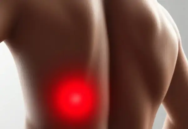 Gros plan sur le dos d'une personne, avec une zone rouge vif indiquant une douleur au dos gauche.
