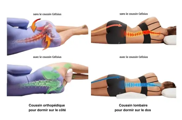 Comparaison de la posture de sommeil : sans coussin, la colonne vertébrale est tordue, causant douleur au muscle du dos. Avec coussin, alignement amélioré.