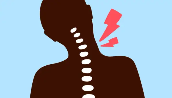 Silhouette d'une personne souffrant d'un torticolis chaud ou froid, avec des éclairs rouges symbolisant la douleur au niveau du cou.