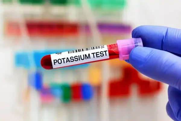 Main tenue un tube de test sanguin étiqueté "POTASSIUM TEST". Un manque de potassium peut être détecté.