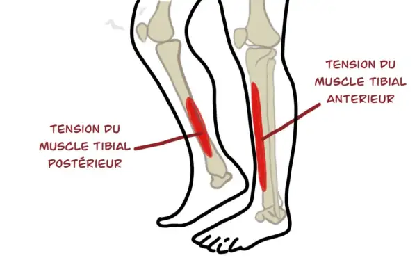Schéma des muscles du tibia. La douleur au tibia en course à pied chez le débutant peut être liée à la tension du muscle tibial antérieur ou postérieur.