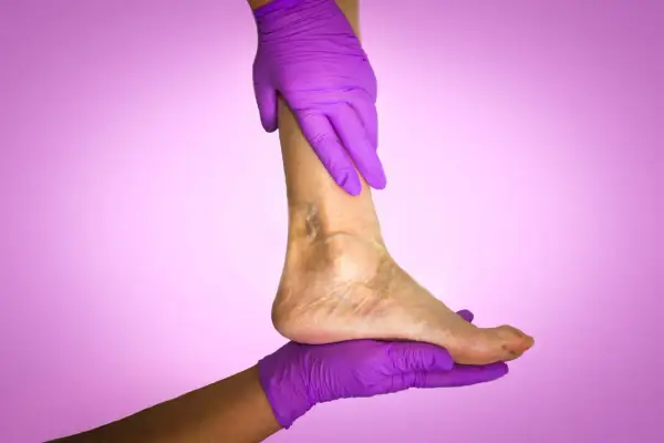 Mains gantées de violet soutiennent une jambe montrant des signes de mauvaise circulation sanguine.