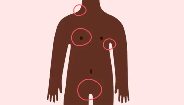 Silhouette féminine avec des cercles rouges indiquant des zones d'intérêt, dont ou se situe l'aine femme.