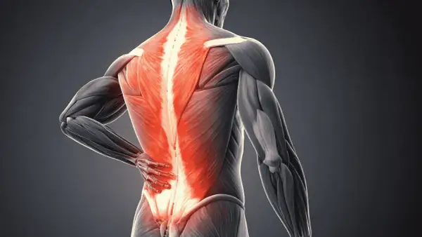 Anatomie d'un homme montrant la douleur du dos droite, avec les muscles du bas du dos illuminés en rouge vif.