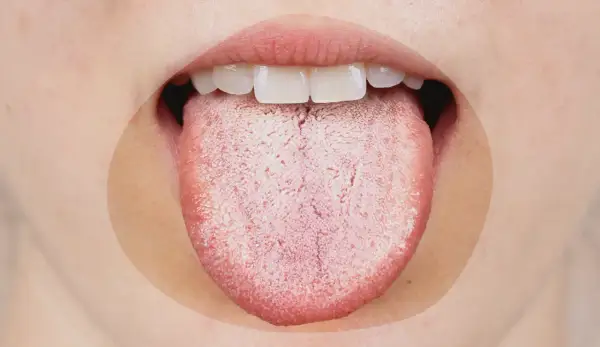 Une langue blanche et râpeuse, signe possible de stress ou d'une infection.