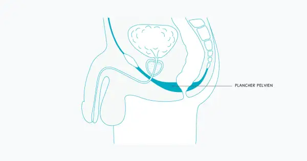 Schéma anatomique montrant le muscle pelvien homme, essentiel pour le soutien des organes et la fonction urinaire.