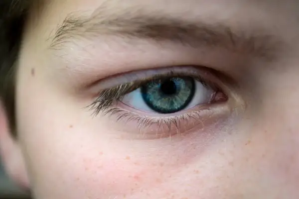Gros plan sur un œil bleu-vert, avec des taches de rousseur sur la joue. La paupière qui tremble depuis plusieurs semaines est visible.