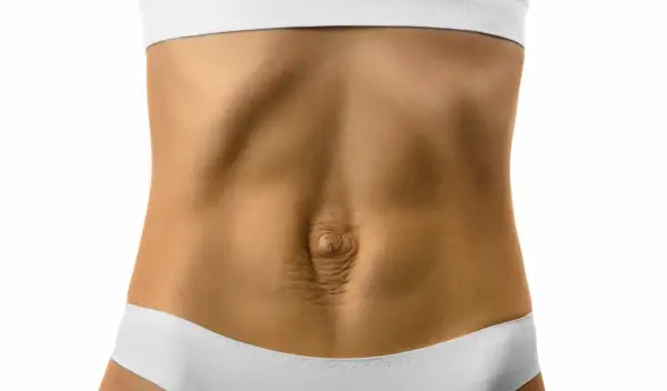 Ventre avec peau relâchée et vergetures, montrant un possible diastasis. Comment savoir si c'est le cas ?